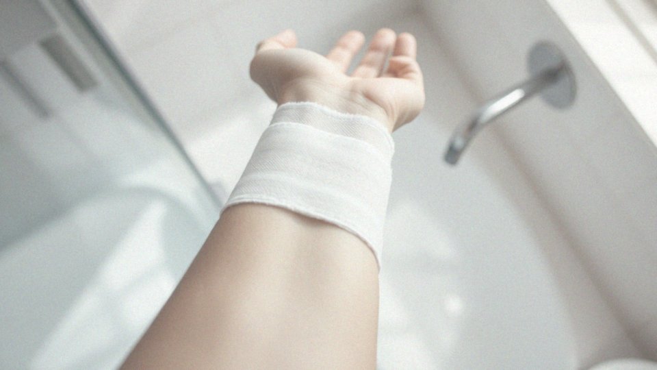 Gojenie rany po szyciu – jak dbać o prawidłową pielęgnację?