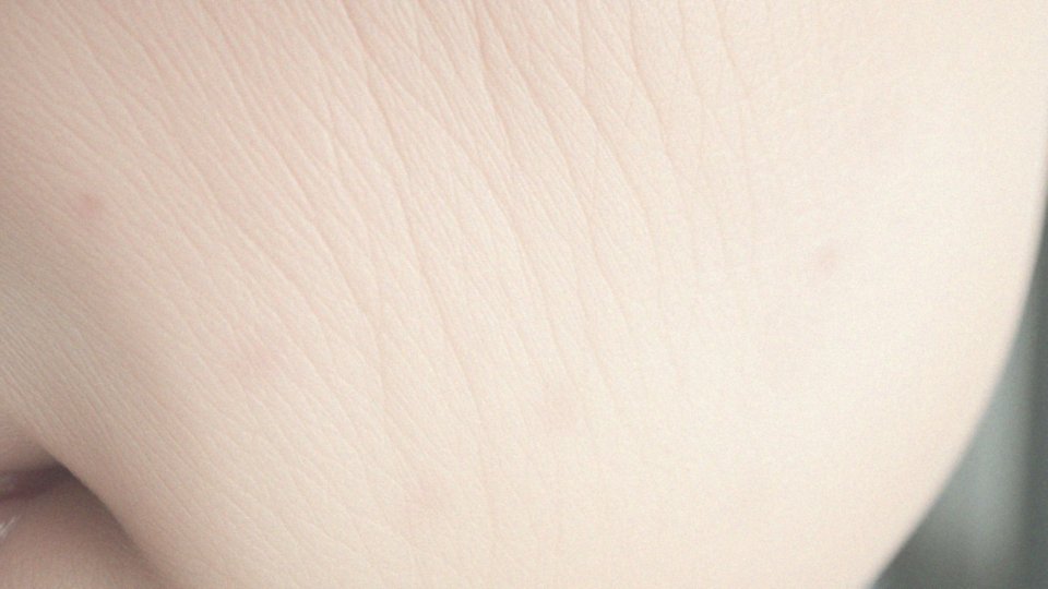 Po botoksie więcej zmarszczek? Fakty i mity o zabiegu